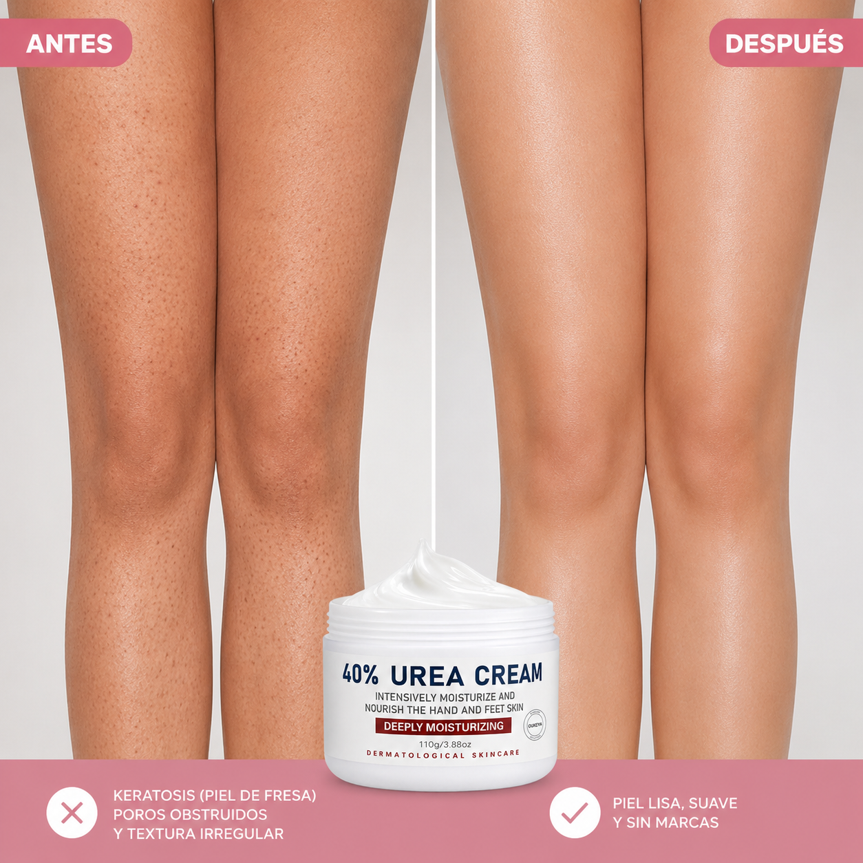 Crema Hidratante para Pies Secos y Agrietados | Elimina Fisuras, Durezas y Tacones Agrietados | Crema Urea al 40% - 110gr