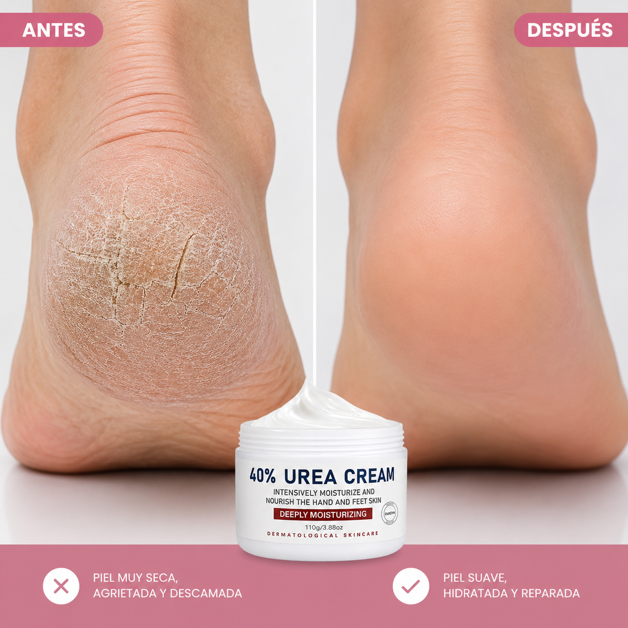 Crema Hidratante para Pies Secos y Agrietados | Elimina Fisuras, Durezas y Tacones Agrietados | Crema Urea al 40% - 110gr